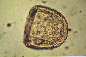 Wurmei unter Mikroskop